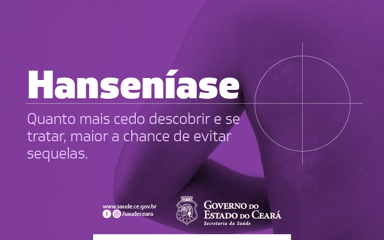 Janeiro Roxo tem diagnóstico e prevenção da Hanseníase como temas