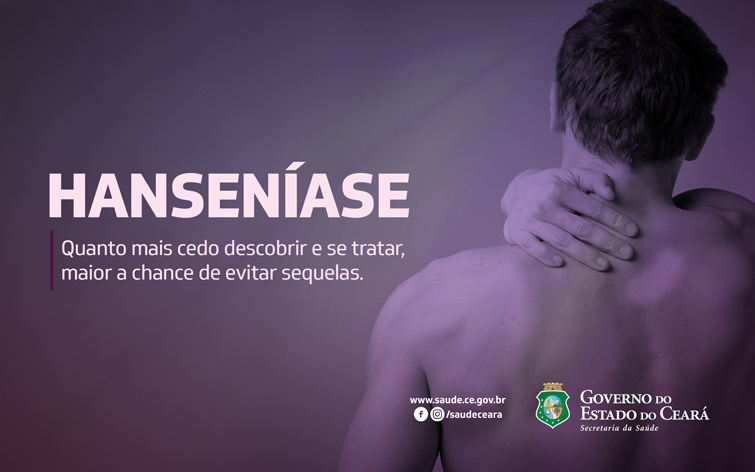 Hanseníase - descubra quais são aa causas, sintomas e tratamento 